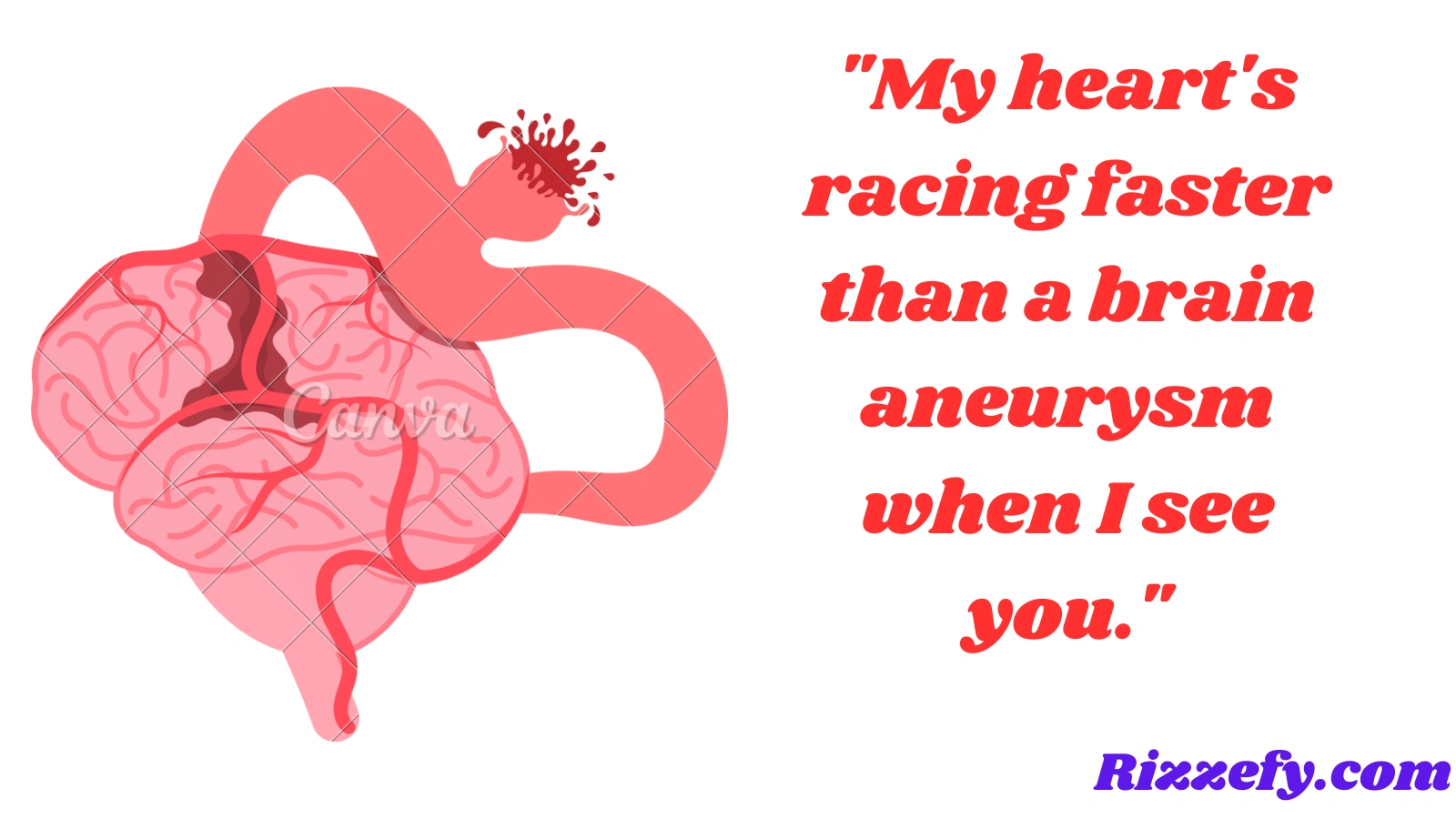 Aneurysm Pickup Lines